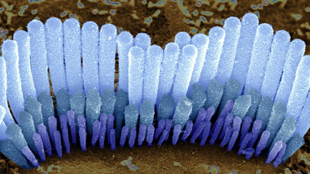 cellule ciliate orecchio interno 1024x576