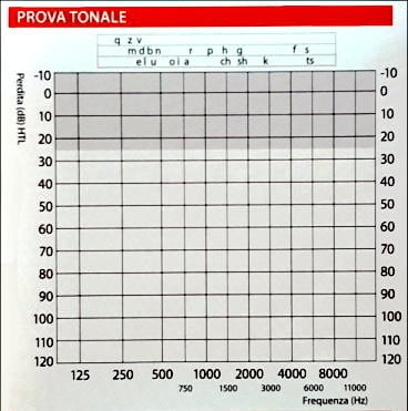 Prova tonale - test audiometrico
