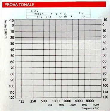 Prova tonale - test audiometrico