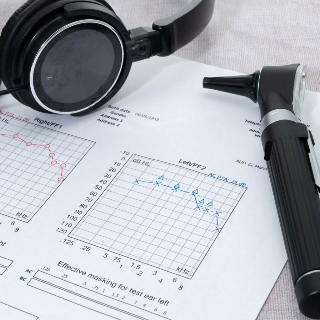 come trattare l'ipoacusia